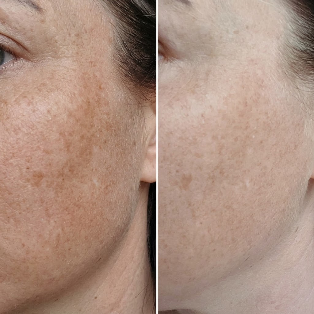 Brighter-looking complexion