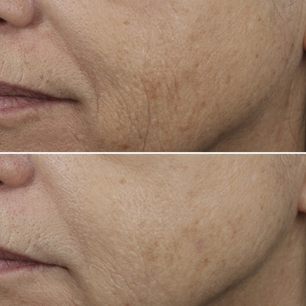 More supple-looking skin