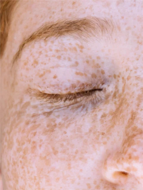Radiant Complexion Vitamin C Serum