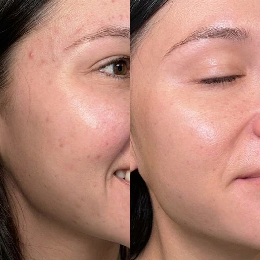 Smoother-looking skin